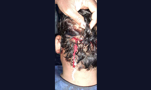 സി.പി.എം വിട്ട്​ സി.പി.​െഎയിൽ ചേർന്നയാൾക്ക്​ മർദനം