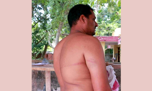 ജോലി കഴിഞ്ഞ് വീട്ടിലേക്ക്​ മടങ്ങിയ യുവാവിന് പൊലീസി​െൻറ മർദനം; എ​സ്.​ഐ​ക്ക്​ സ​സ്പെ​ൻ​ഷ​ൻ