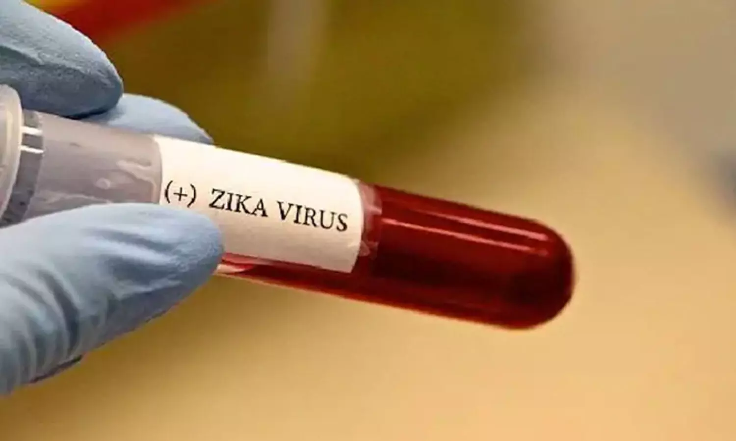 zika virus