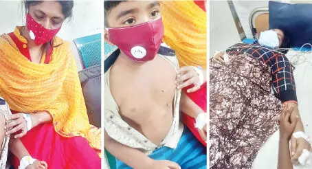 ആറുവയസ്സുകാരനടക്കം നാലുപേർക്ക് പേപ്പട്ടിയുടെ കടിയേറ്റു ആറുവയസ്സുകാരനടക്കം നാലുപേർക്ക് പേപ്പട്ടിയുടെ കടിയേറ്റു