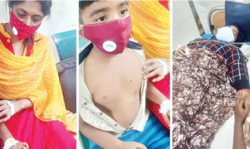 ആറുവയസ്സുകാരനടക്കം നാലുപേർക്ക്​ പേപ്പട്ടിയുടെ കടിയേറ്റു