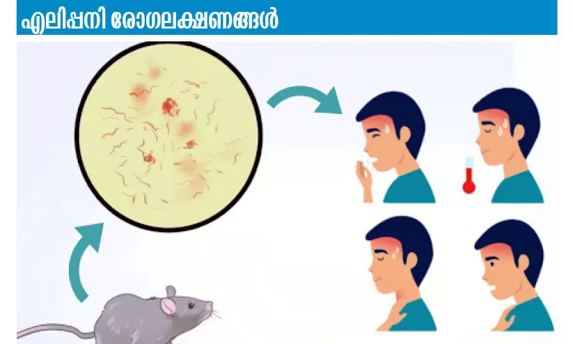 ഇല്ലം ചുടേണ്ട പക്ഷേ, എലിപ്പനിയെ പേടിക്കണം; എലിപ്പനിയെ പ്രതിരോധിക്കാന​ുള്ള വഴികൾ