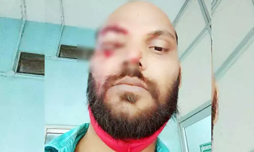 മയക്കുമരുന്ന്​ സംഘം യുവാവി​െൻറ കണ്ണ് കുത്തിപ്പൊട്ടിക്കാൻ ശ്രമിച്ചു