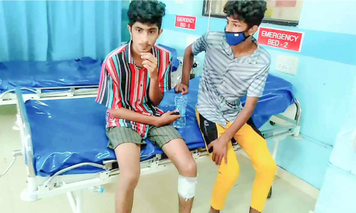 മ​ദ്യ​ല​ഹ​രി​യിൽ പടക്കമേറ്​; വിദ്യാർഥിക്ക് പരിക്ക്