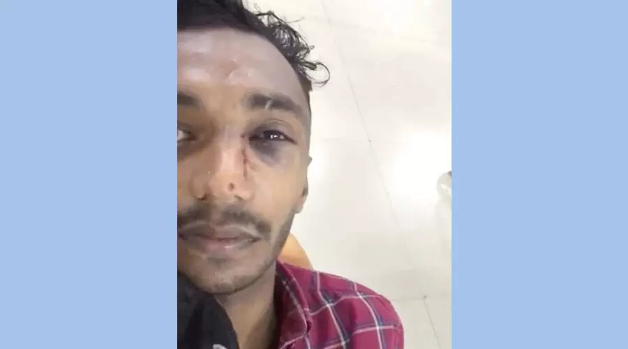 ഇരുചക്രവാഹനം കഴുകുന്നതുമായി ബന്ധപ്പെട്ട തർക്കം; സർവിസ് സ്​റ്റേഷൻ ഉടമക്കെതിരെ ആക്രമണം