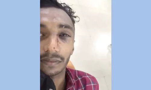 ഇരുചക്രവാഹനം കഴുകുന്നതുമായി ബന്ധപ്പെട്ട തർക്കം; സർവിസ് സ്​റ്റേഷൻ ഉടമക്കെതിരെ ആക്രമണം