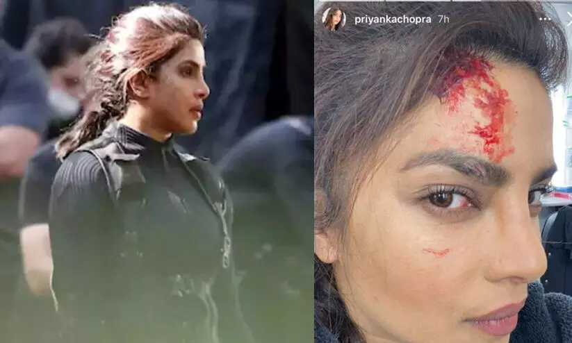 അവഞ്ചേഴ്​സ്​ നിർമാതാക്കളൊരുക്കുന്ന സീരീസ്​ ചിത്രീകരണത്തിനിടെ പ്രിയങ്ക ചോപ്രക്ക്​ പരിക്ക്​