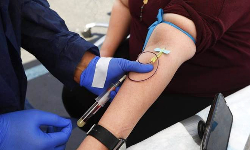 Sero-prevalence survey Sero-prevalence survey