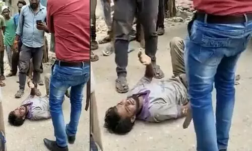 Man brutally attacked by those who accused him of stealing bus batteries