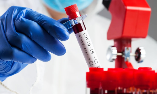 seroprevalence study