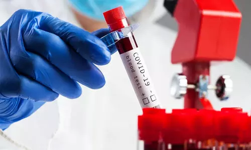 seroprevalence study