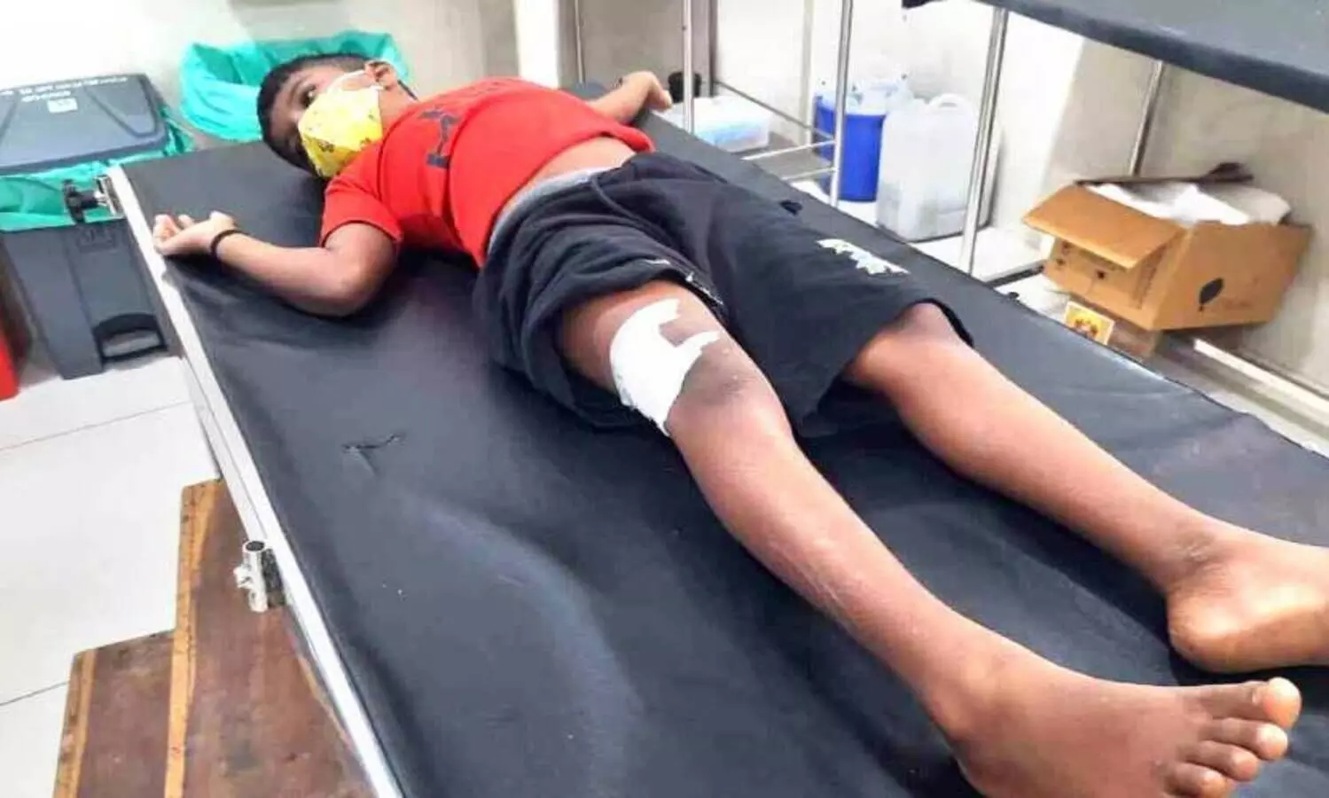 വീടിനു മുന്നിൽ കളിക്കുകയായിരുന്ന കുട്ടിയെ കാട്ടുപന്നി ആക്രമിച്ചു