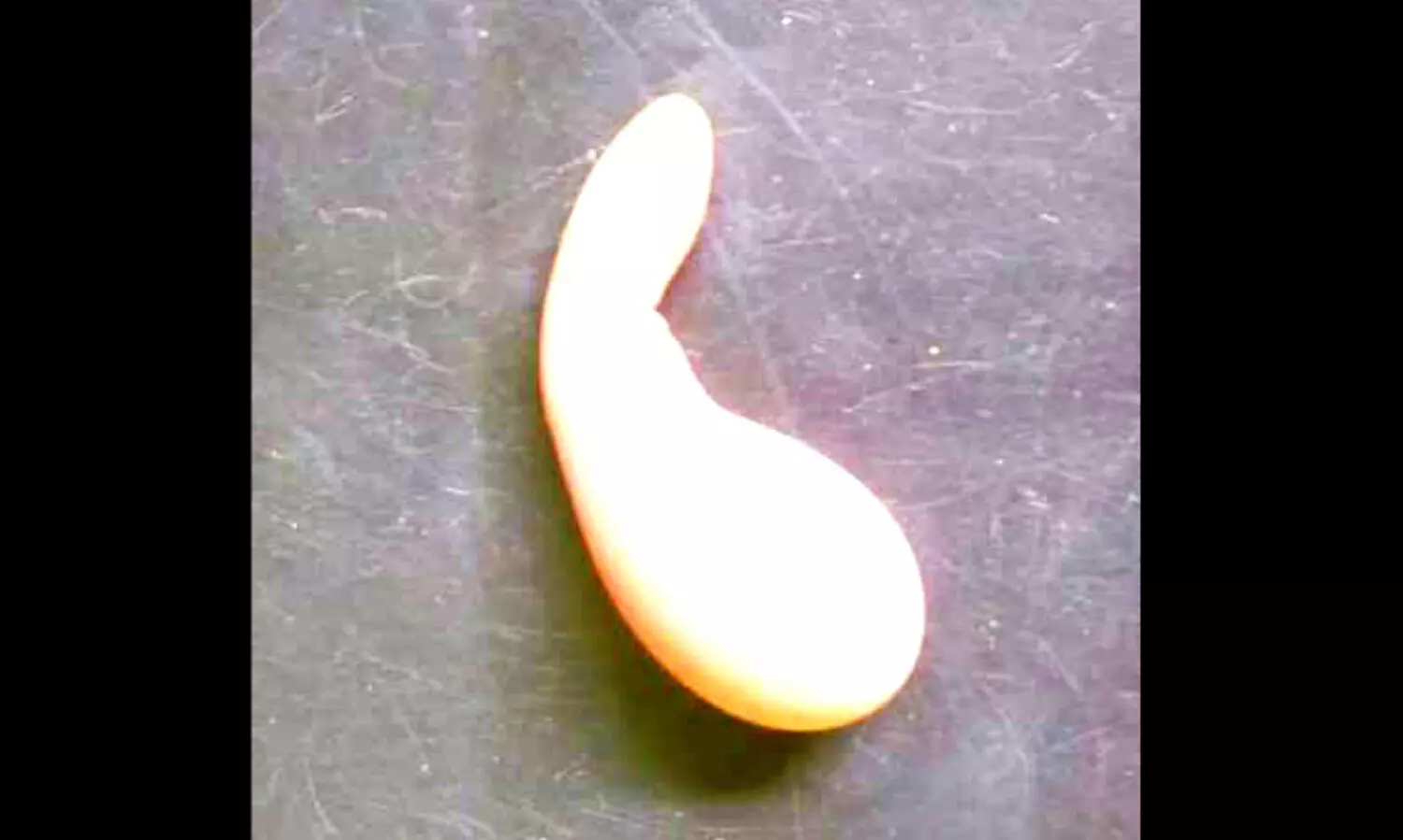 വാ​ഴ​ക്കു​ളത്ത് വിചിത്ര മുട്ട കൗതുകമായി