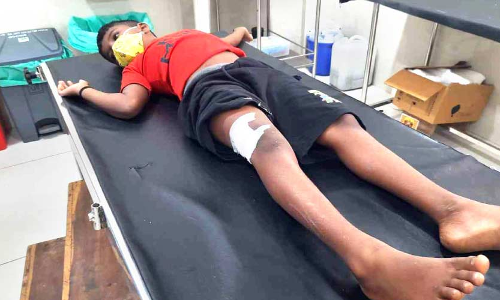 വീടിനു മുന്നിൽ കളിക്കുകയായിരുന്ന കുട്ടിയെ കാട്ടുപന്നി ആക്രമിച്ചു