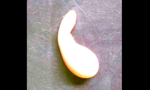 വാ​ഴ​ക്കു​ളത്ത് വിചിത്ര മുട്ട കൗതുകമായി