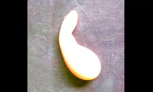 വാ​ഴ​ക്കു​ളത്ത് വിചിത്ര മുട്ട കൗതുകമായി