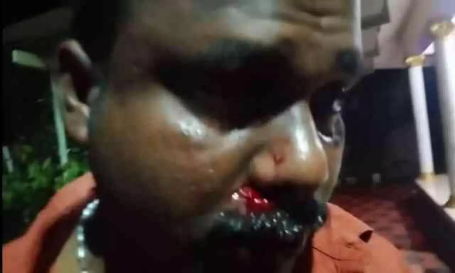 injured thomas chacko