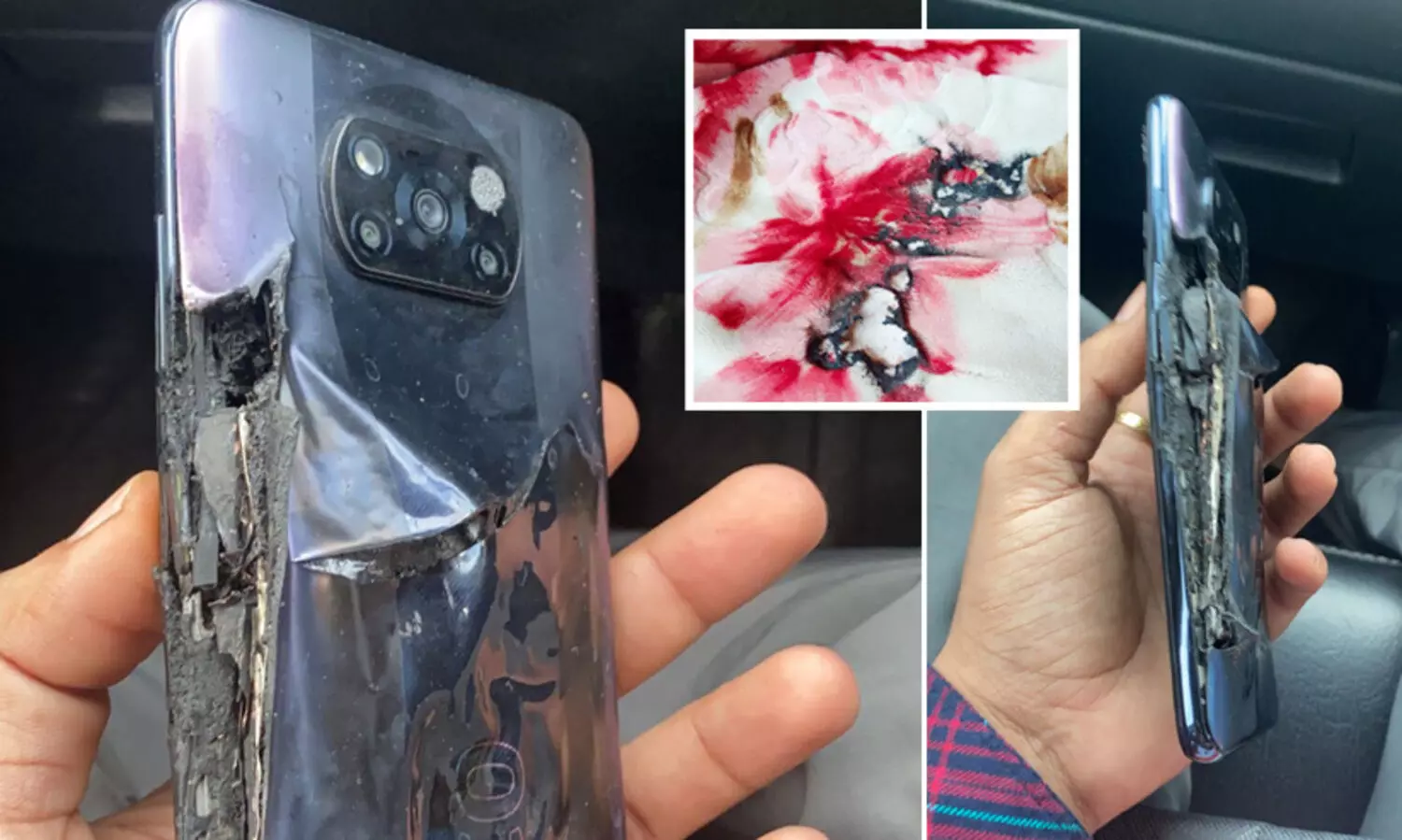 ഫുൾ ചാർജ്​ ചെയ്​ത്​ മിനിറ്റുകൾക്കകം മൊബൈൽ ഫോൺ പൊട്ടിത്തെറിച്ചു; പരാതിയുമായി യുവാവ്​