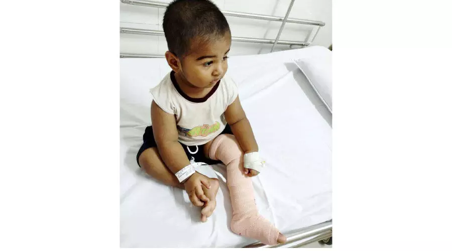 പ്ര​തി​രോ​ധ കു​ത്തി​വെ​െ​പ്പ​ടു​ത്ത ഒ​ന്ന​ര വ​യ​സ്സു​കാ​ര​െൻറ കാ​ലി​ന് ത​ക​രാ​റെന്ന്​