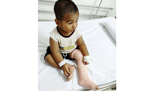 പ്ര​തി​രോ​ധ കു​ത്തി​വെ​െ​പ്പ​ടു​ത്ത ഒ​ന്ന​ര വ​യ​സ്സു​കാ​ര​െൻറ കാ​ലി​ന് ത​ക​രാ​റെന്ന്​