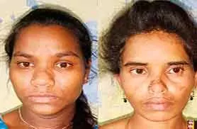 മൂ​ന്ന്​ കോ​ടി​യുടെ ഹ​ഷീ​ഷ് ഓ​യി​ലു​മാ​യി പിടിയിലായവർ ലഹരി മൊത്തകച്ചവട സംഘം