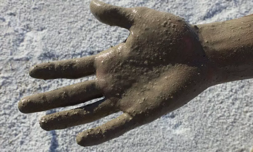 വെള്ളം തെറിപ്പിച്ചതിന്​ കാർ ഡ്രൈവറെ ചെളിവെള്ളത്തിൽ കുളിപ്പിച്ച്​ ഓ​ട്ടോ ഡ്രൈവർ