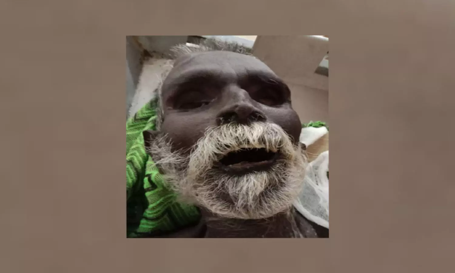 ആശുപത്രിയിൽ മരിച്ചയാളെ തിരിച്ചറിഞ്ഞില്ല