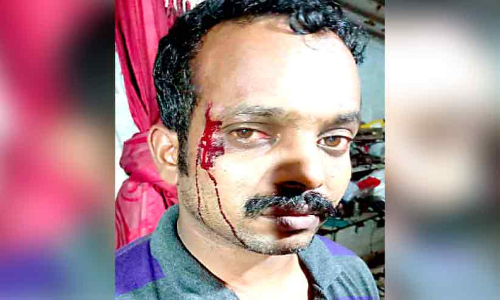കൂലി ചോദിച്ച വർക്ക്ഷോപ് ഉടമയെ കല്ലുകൊണ്ട്​ ഇടിച്ച്​ പരിക്കേൽപിച്ചു