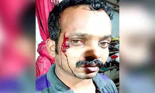 കൂലി ചോദിച്ച വർക്ക്ഷോപ് ഉടമയെ കല്ലുകൊണ്ട്​ ഇടിച്ച്​ പരിക്കേൽപിച്ചു