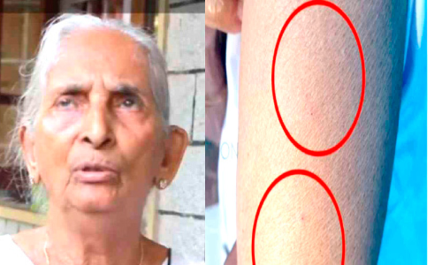 അരമണിക്കൂറിൽ രണ്ട് ഡോസ് വാക്​സിൻ; ഞെ​ട്ടൽ മാറാതെ​ വയോധിക