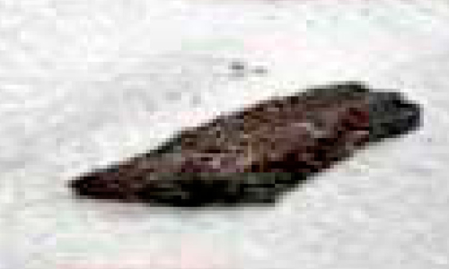 മരക്കഷണം വിഴുങ്ങിയ കുഞ്ഞിന് ശസ്ത്രക്രിയ വഴി പുതുജീവിതം