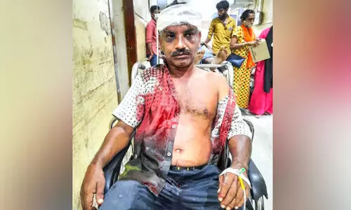 ലി​ഫ്റ്റ് ചോ​ദി​ച്ച് ക​യ​റി​യ ട്രാ​ൻ​സ് യു​വ​തി ബൈ​ക്ക് യാ​ത്രി​ക​െൻറ ത​ല അ​ടി​ച്ചു​പൊ​ട്ടി​ച്ചു