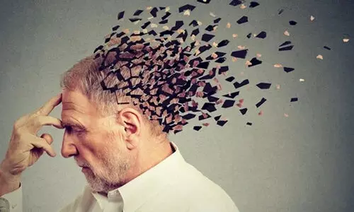 ഇന്ന്​ ലോ​ക അ​ൽ​ഷൈ​മേ​ഴ്സ് ദി​നം: മറവി രോഗത്തിൻെറ കാരണങ്ങൾ, ഘട്ടങ്ങൾ, തടയാൻ ചെയ്യേണ്ടത്....