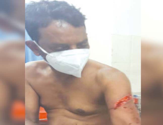 ഫേസ്ബുക്ക് പോസ്റ്റിനെച്ചൊല്ലി വാക്കേറ്റം; ഒരാൾക്ക് വെട്ടേറ്റു ഫേസ്ബുക്ക് പോസ്റ്റിനെച്ചൊല്ലി വാക്കേറ്റം; ഒരാൾക്ക് വെട്ടേറ്റു