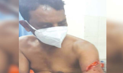 ഫേസ്​ബുക്ക് പോസ്​റ്റിനെച്ചൊല്ലി വാക്കേറ്റം; ഒരാൾക്ക്​ വെട്ടേറ്റു