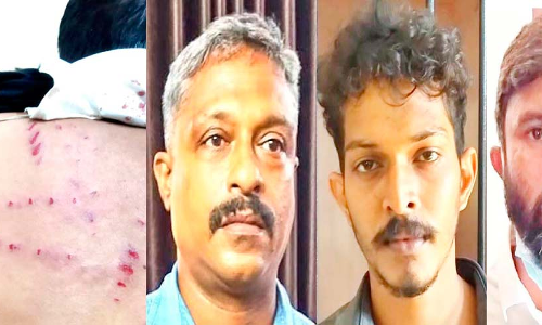 Inter-state worker brutally beaten at hotel