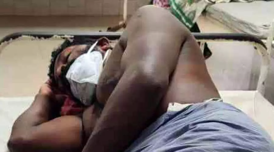 കിണറുപണിക്കിടെ കല്ല് തലയിലേക്കിട്ട് കൊല്ലാന് ശ്രമം കിണറുപണിക്കിടെ കല്ല് തലയിലേക്കിട്ട് കൊല്ലാന് ശ്രമം