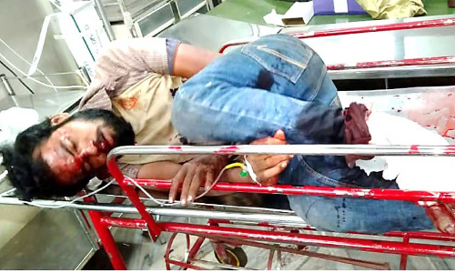 അജ്ഞാത വാഹനമിടിച്ച്​ യുവാവിന്​ ഗുരുതര പരിക്ക്