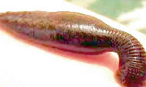 തോട്ടപ്പുഴു ശല്യത്തിൽ വലഞ്ഞ് മലയോര മേഖല;  കാ​ലി​ലെ വി​ര​ലു​ക​ൾ​ക്കി​ട​യി​ലാ​ണ് ഇ​ത് കൂ​ടു​ത​ലും ക​ടി​ക്കു​ക