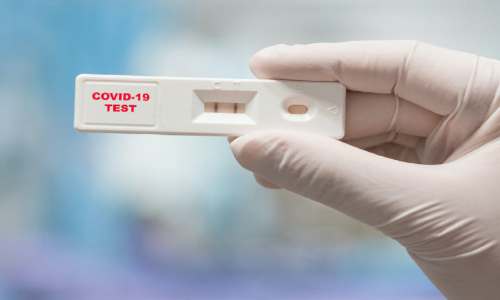 എറണാകുളത്തെ ലാബുകളില്‍ ആൻറിജന്‍ ടെസ്​റ്റിന് കർശന നിരോധനം