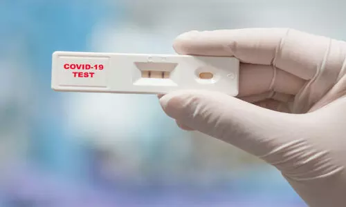 എറണാകുളത്തെ ലാബുകളില് ആൻറിജന് ടെസ്റ്റിന് കർശന നിരോധനം എറണാകുളത്തെ ലാബുകളില് ആൻറിജന് ടെസ്റ്റിന് കർശന നിരോധനം