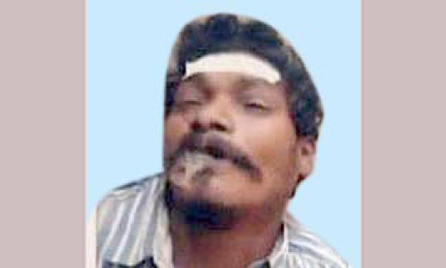 തെ​രു​വു​നാ​യു​ടെ ക​ടി​യേ​റ്റ​യാ​ൾ മ​രി​ച്ചു