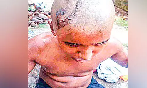 Child with a head injury did not receive treatment from the medical college