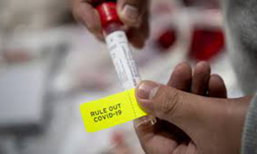 ക്വാറൻറീൻ മാർഗനിർദേശം ലംഘിച്ചവർക്കെതിരെ നടപടി