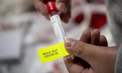 ക്വാറൻറീൻ മാർഗനിർദേശം ലംഘിച്ചവർക്കെതിരെ നടപടി