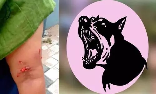 കുന്നത്തൂരിൽ നാലുപേർക്ക് പേപ്പട്ടിയുടെ കടിയേറ്റു കുന്നത്തൂരിൽ നാലുപേർക്ക് പേപ്പട്ടിയുടെ കടിയേറ്റു