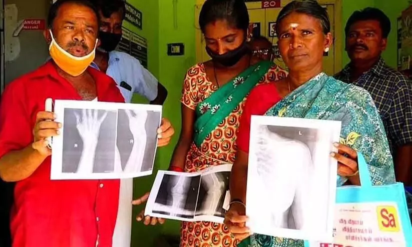 This government hospital in Tamil Nadu prints X-rays on paper