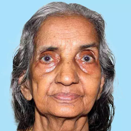 രു​ഗ്​​മി​ണി