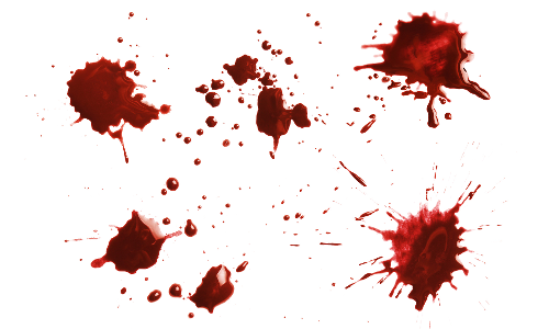 യുവാവിനെ കാൽ അറ്റ നിലയിൽ ക​ണ്ടെ​ത്തി; ദുരൂഹത