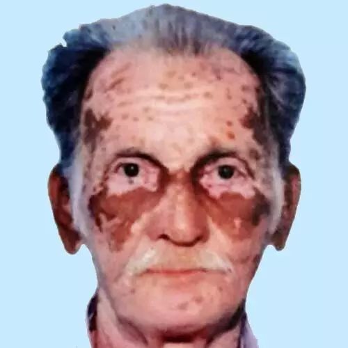 ​ഈ​പ്പ​ൻ ഇ​ടി​ക്കു​ള